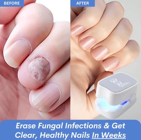 DuoAction Nail Laser™