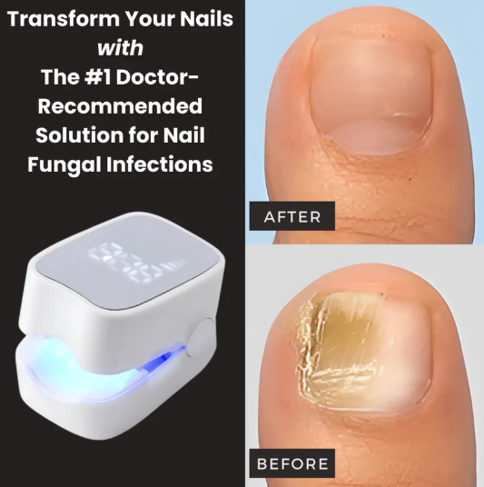 DuoAction Nail Laser™