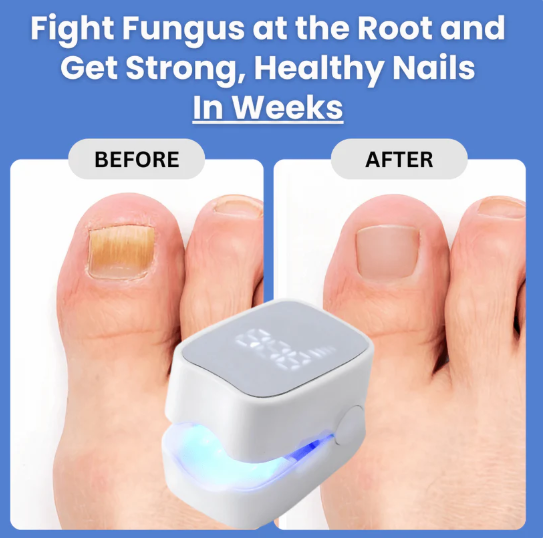 DuoAction Nail Laser™
