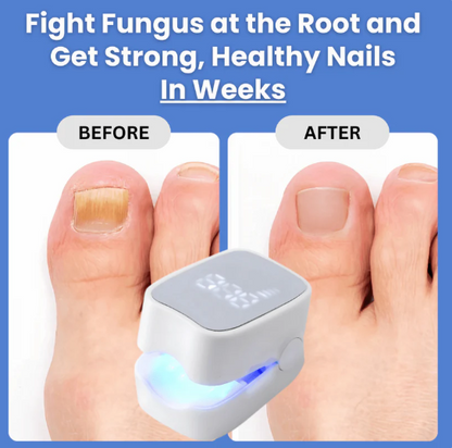 DuoAction Nail Laser™